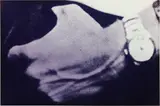 Richard Prince, Untitled (Man's hand with watch)