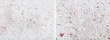 Dan Colen, Moments Like This Never Last