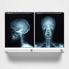 Self Portrait L. by Damien Hirst, 2008, Multiple comprising light box and two x-ray films, sold Oct 2024