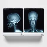 Damien Hirst, Self Portrait L., 2008, Multiple comprising light box and two x-ray films