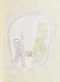 Gerhard Hoehme, "Vaginale Spirale"