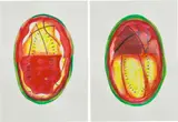 Vaughn Spann, A Prompt Response (Diptych 10)