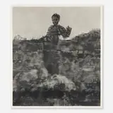 Kon Trubkovich, Clubfoot