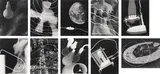 Man Ray, Électricité, Paris: La Compagnie Parisienne de Distribution d'Électricité, 1931. Portfolio of 10 photogravures after Rayographs