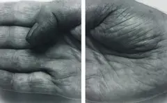 John Coplans, Hand, 1988, gelatin silver print mounted to board, diptych