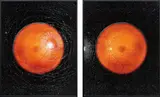 Mikhael Subotzky, Self-portrait (with the help of optometrist) R and L from Retinal Shift