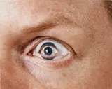 Anne Collier, Eye, 2004, Chromogenic print, flush-mounted