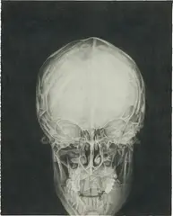Tom Molloy, Self Portrait, 2001-2002, pencil on paper