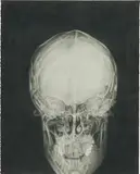 Tom Molloy, Self Portrait, 2001-2002, pencil on paper