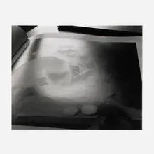 Abelardo Morell, Book: Boy with Fruit by Caravaggio, 1993, gelatin silver print
