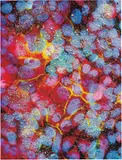 Damien Hirst, Second Series Biopsy: M122/105-Breast_cancer_cells,_immunofluorescent_light_micrograph-SPL.jpg, 2008, UV inks and household gloss on canvas with glass, scalpel blades, flocking and religious medals