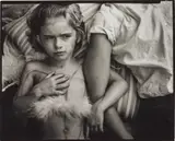 Sally Mann, Jessie Bites