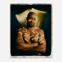 Anthony Barboza, Scars N.Y., 1993, unique large-format Polaroid Polacolor print