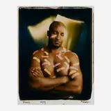 Anthony Barboza, Scars N.Y., 1993, unique large-format Polaroid Polacolor print