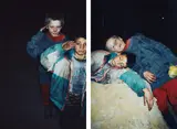 Boris Mikhailov, Untitled from Case History, 1997-1998, Two chromogenic prints