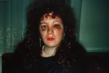 Nan one month after being battered by Nan Goldin, 1984, cibachrome print, offered Dec 2014