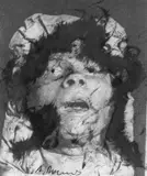 Arnulf Rainer, Leiche