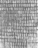 Herbert Zangs, Ohne Titel