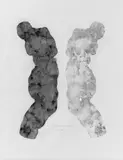 Jürgen Brodwolf, Ohne Titel (Figurenprägung)