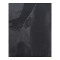 Kiko Escora, Untitled, oil on canvas