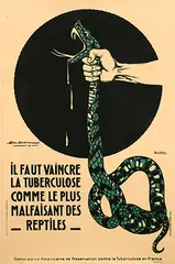 Géo Dorival, Il faut vaincre La Tuberculose, 1918, poster