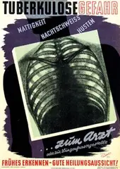 Gerhard C. Schulz, Tuberkulose Gefahr, poster