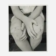 William Abranowicz, Kerry's Knees, 1989, gelatin silver print