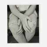 William Abranowicz, Kerry's Knees, 1989, gelatin silver print