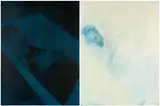 Gottfried Helnwein, Ohne Titel (Barschel)
