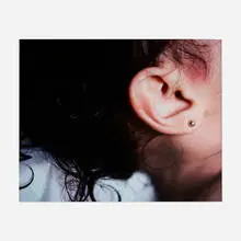 Child Abuse II (from the Morgue series) by Andres Serrano, 1996, Cibachrome print, sold Mar 2024