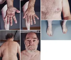 Peter Paul Skin Sample (für Parkett 73) by Paul McCarthy, 2005, Jeweils: C-Print auf Kodak Professional, sold Oct 2023