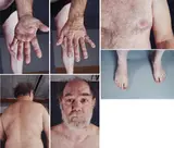 Paul McCarthy, Peter Paul Skin Sample (für Parkett 73)