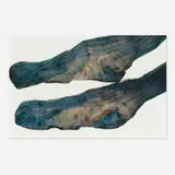 Miyako Ishiuchi, Untitled (from the Hiroshima series), 2007, archival digital inkjet print on watercolor paper mounted to Dibond