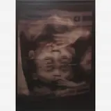 Cabelo, Mianmar Miroir, 2006