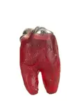 Tunga, O Dente