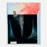 Josesph Diggs, The Cancer- Death of a Baller, 2017, x-ray, photograph, brass screws, and oil on wood panel