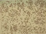 Ed Ruscha, Red Ants; Swarm of Red Ants (from Insects) (2), 1972, 5-color screenprint on Fabriano Classico glazed-finish watercolor paper