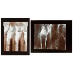 Olivia Parker, Selected Images (comprising 'Silver Heat' and 'Moment'), 1976, Two selenium-toned silver chloride prints