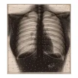 Lucas Samaras, Untitled, circa 1960, pins and printed x-ray laid on board