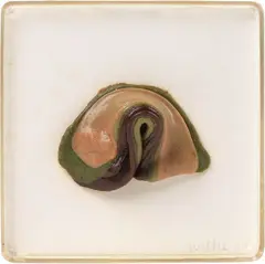 Hannah Wilke, Meeded Eraser-Her, 1977, scultura in chewing-gum montata on pannello