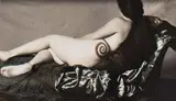 Joel-Peter Witkin, Calculated Birthmark, 1986, photograph