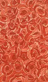 Richmond Burton, Flesh Valentine, 1996, etching and aquatint on Somerset paper