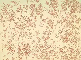 Ed Ruscha, Red Ants (from Insects Portfolio), 1972, 5-color screenprint on Fabriano Classico glazed-finish watercolor paper