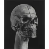 Robert Mapplethorpe, Skull Walking Cane, 1988, Gelatin silver print; flush-mounted, the photographer's estate stamp