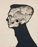 Jack Stuck, Self Portrait Teeth, 1967, Intaglio with acrylic