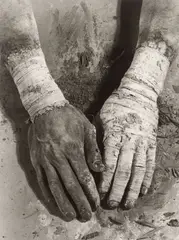 Dieter Appelt, Die Befreiung der Finger“, aus der Serie „Erinnerungsspur“, 1977–1979, 6 Vintages. Silbergelatineabzüge, davon 5 auf Agfa-Papier