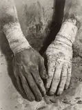 Dieter Appelt, Die Befreiung der Finger“, aus der Serie „Erinnerungsspur“, 1977–1979, 6 Vintages. Silbergelatineabzüge, davon 5 auf Agfa-Papier