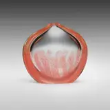 Archimede Seguso, Merletto vase