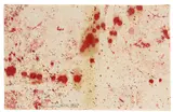 Hermann Nitsch, Ohne Titel, 1988, 2 Arbeiten: jeweils Blut und Acryl auf Nessel
