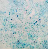 Treponema pallidum, 2024 by Aleksandra Modrzejewska, 2024, olej, płótno, sold Oct 2026